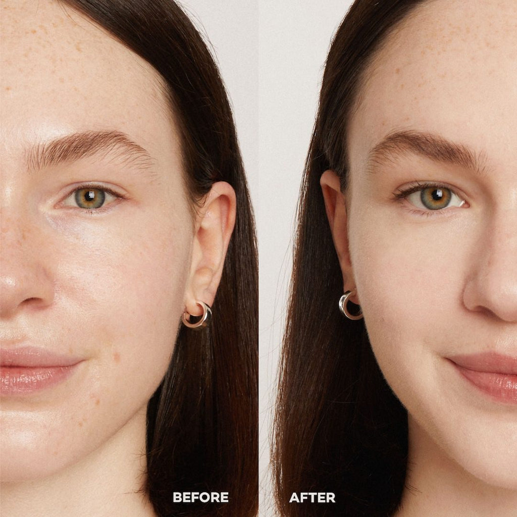 Before and after comparison of a woman's face with visible skin improvement.