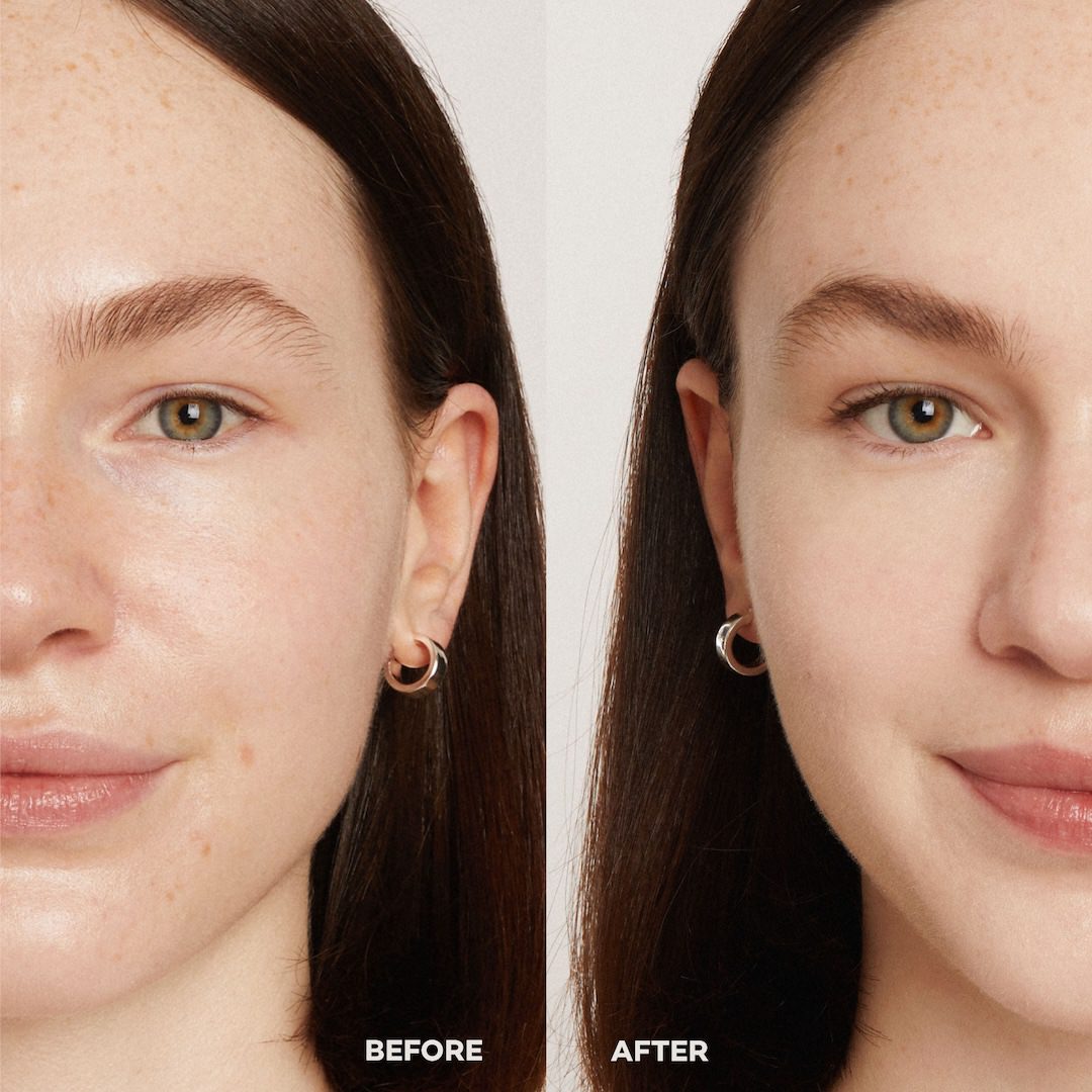 Before and after comparison of a woman's face with visible skin improvement.