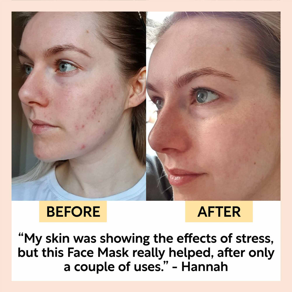 Before and after comparison of a woman's face with text about a face mask's effectiveness.
