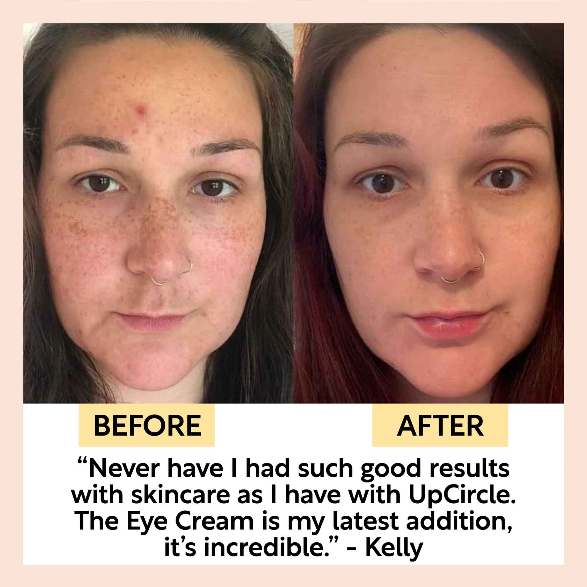 Before and after comparison of a woman's face with text about UpCircle skincare.
