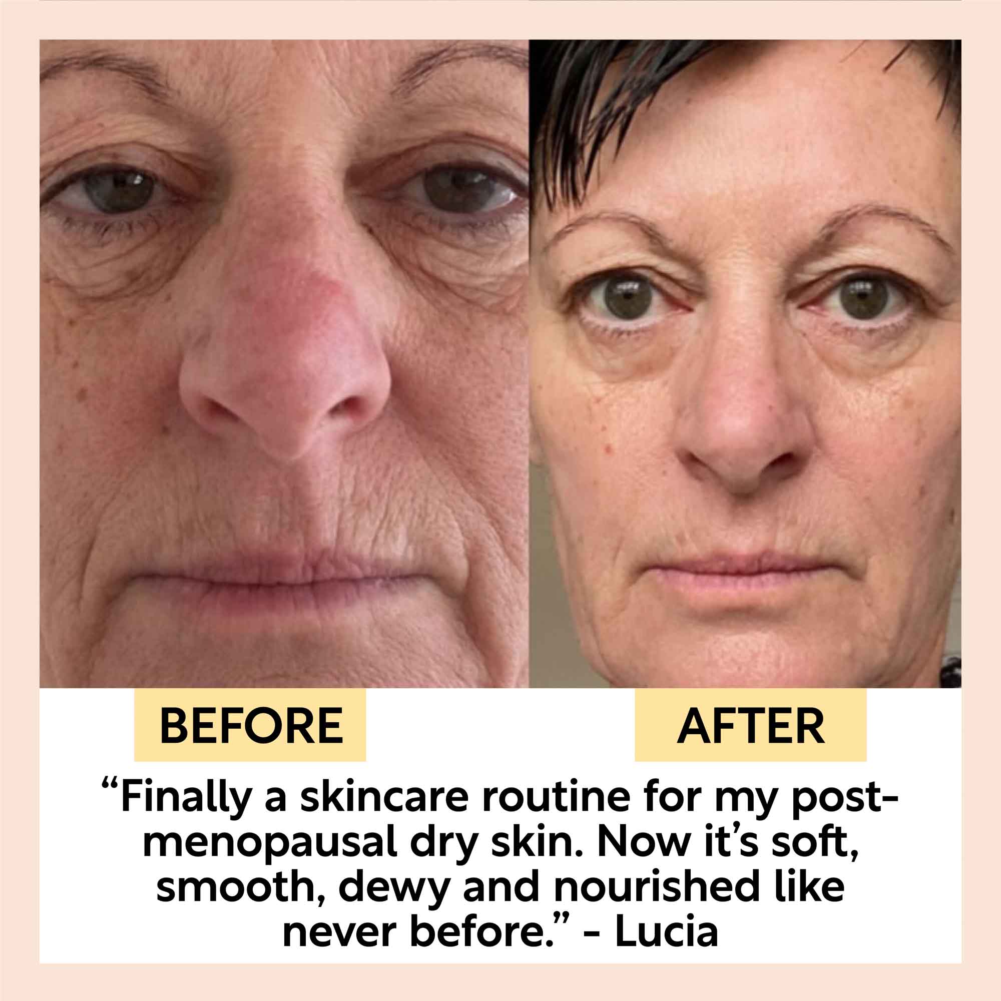 Before and after comparison of a woman's face with text about a skincare routine.