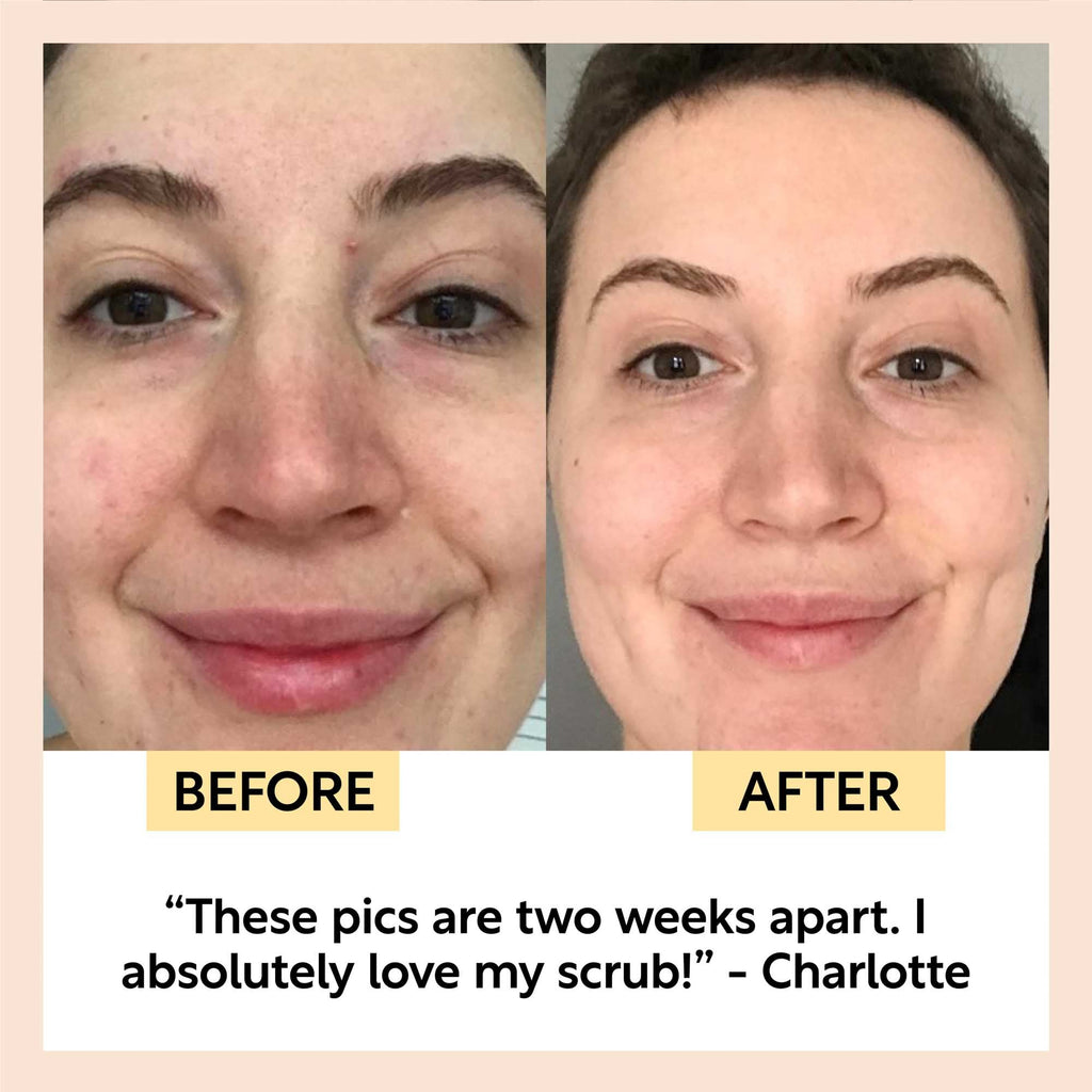 Before and after comparison of a woman's face with text indicating improvement two weeks after using a scrub.