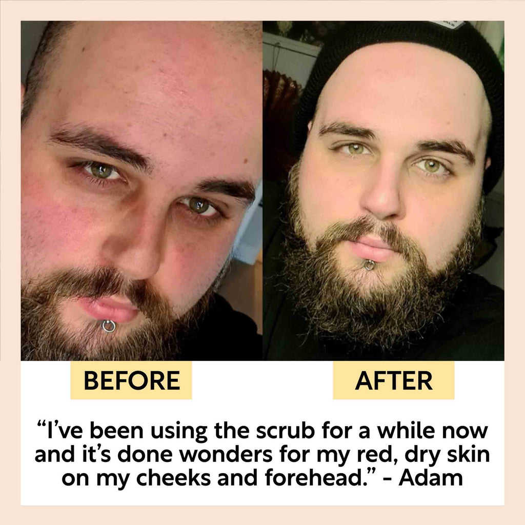 Before and after comparison of a man's face with text about using a scrub.