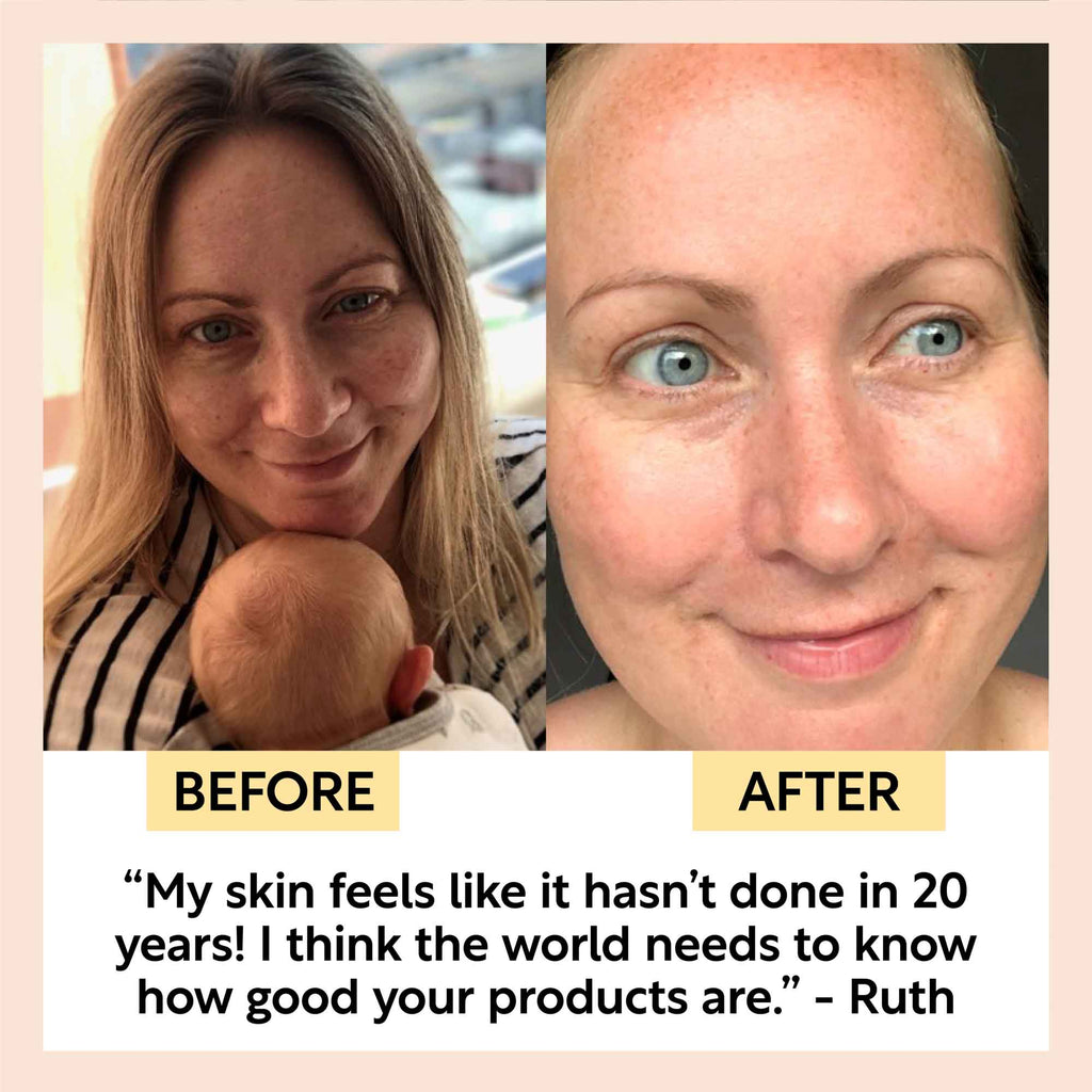 Before and after comparison of a woman with text praising product effectiveness.