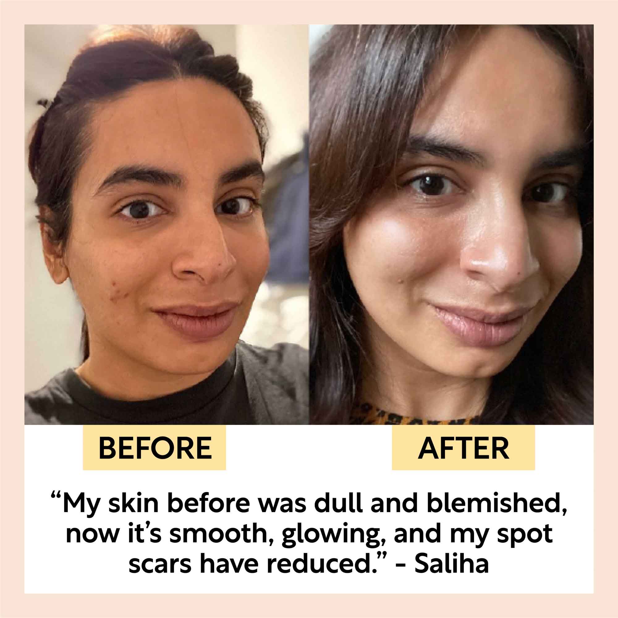 Before and after comparison of a woman's face with text about skin improvement.