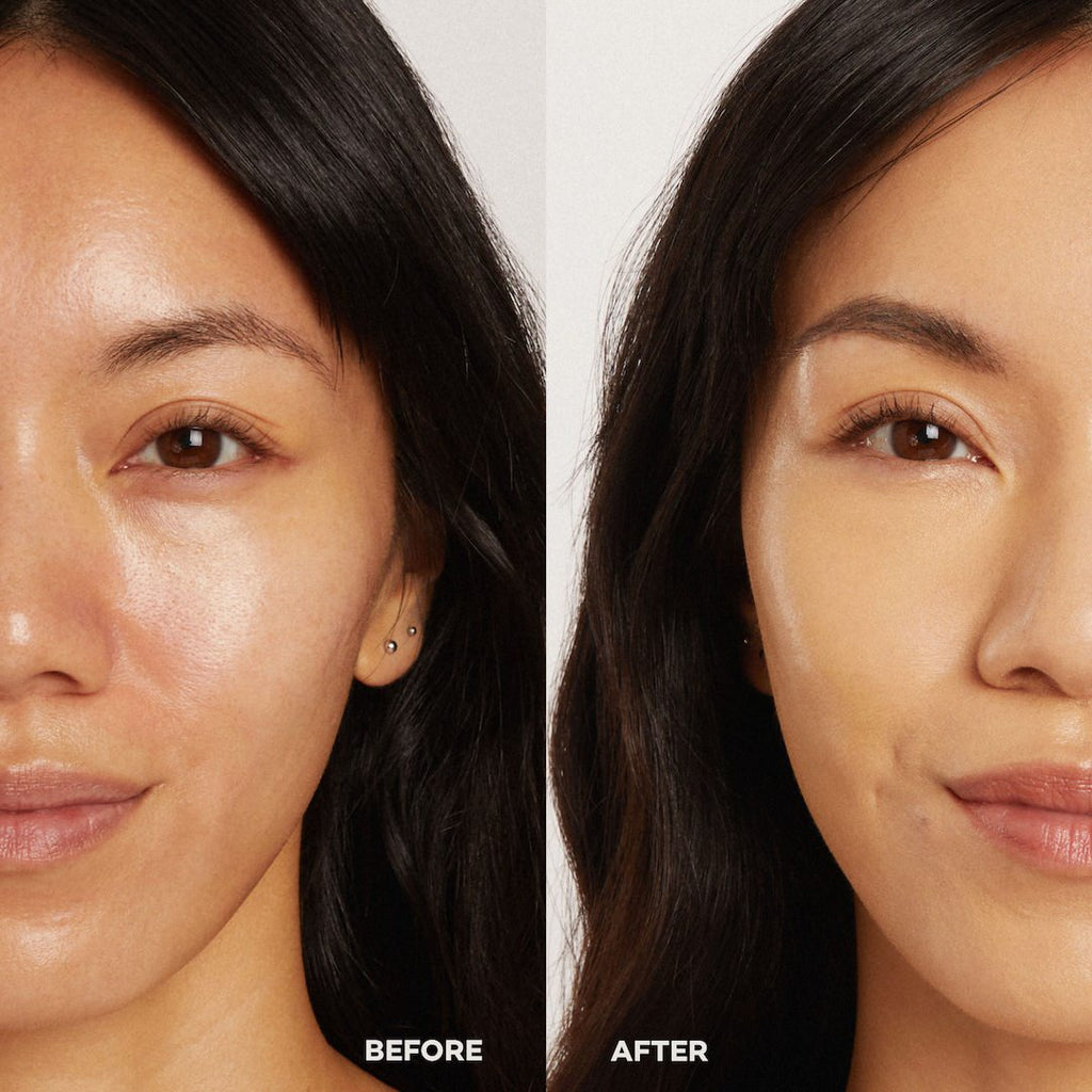 Before and after comparison of a woman's face with visible skin improvement.