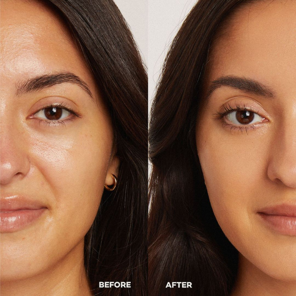 Before and after comparison of a woman's face with visible skin improvement.