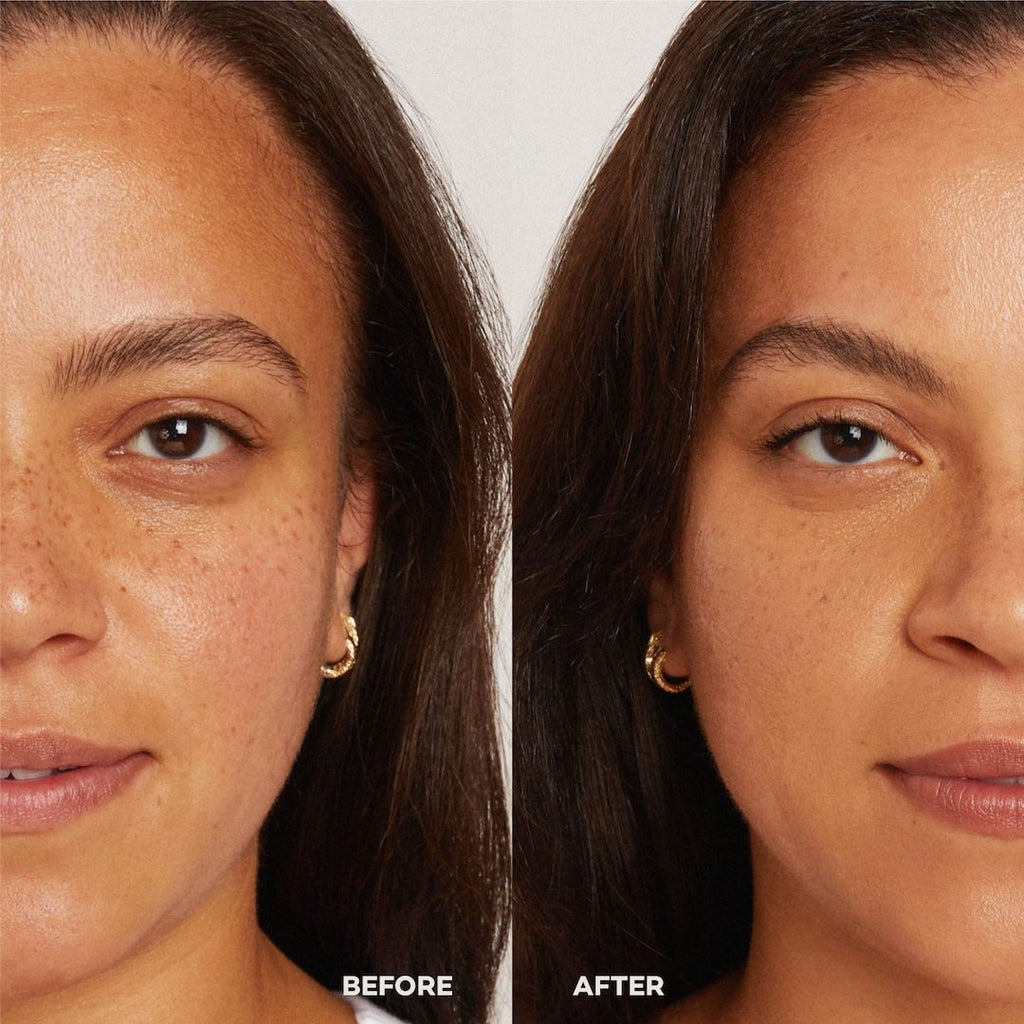 Before and after comparison of a woman's face with visible skin texture differences.