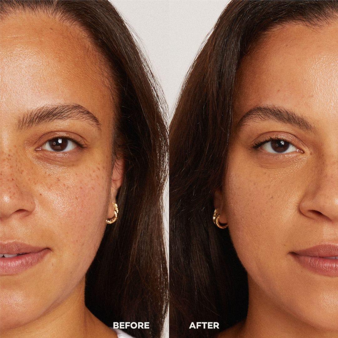 Before and after comparison of a woman's face with visible skin texture differences.