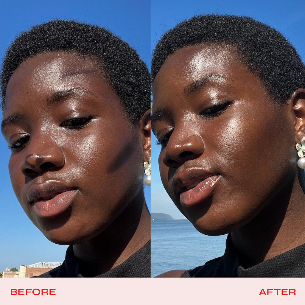 Side-by-side comparison of a woman's face labeled 'Before' and 'After' with a blue sky background.