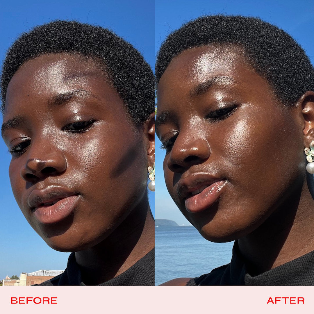 Side-by-side comparison of a woman's face labeled 'Before' and 'After' with a blue sky background.